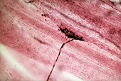 Photomicrograph of a synapse