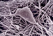 SEM of neurone cell body from the myenteric plexus