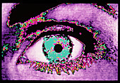 Computer-enhanced image of a woman's eye