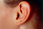 View of teenager's left ear pinna (auricle)