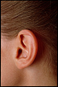 View of a teenage girl's left ear pinna (auricle)
