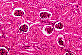 Light micrograph of glomeruli in a kidney section