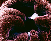 Coloured SEM of the oviduct entrance from uterus