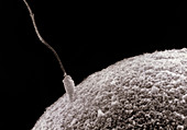 SEM of a sperm penetrating the corona radiata