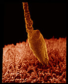 Coloured SEM of a human sperm fertilising an egg