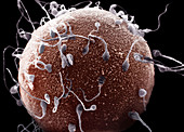 Human Sperm and Egg