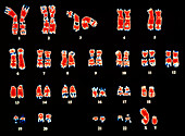 Coloured LM of chromosomes of a normal human male