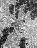 Transmission electron micrograph of cytokinesis