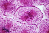 Early prophase of mitosis,LM