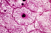 Late prophase of mitosis,LM