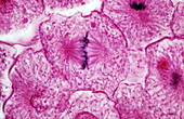 Middle metaphase of mitosis,LM