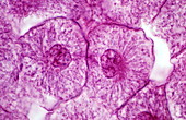 Interphase stage of mitosis,LM