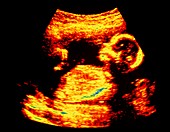 Ultrasound scan of a 16-week-old human foetus