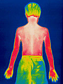 A thermogram of a boy in shorts (back)