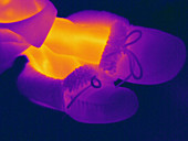Thermogram of Feet in Slippers