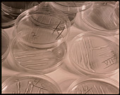 Collection of petri dishes
