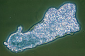 LM of protozoan Amoeba proteus