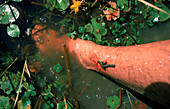 Freshwater leech