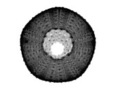 X-ray of Sea Urchin