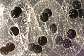 American Toad eggs