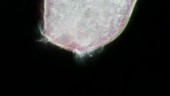 Red stentor, light microscopy