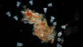 Vorticella, light microscopy