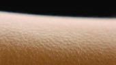 Goosebumps on skin