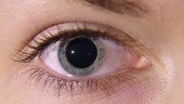 Blue eye with pupil constricting