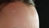 Sweat on forehead