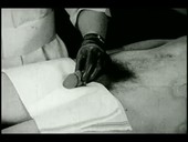 Syphilis tests on penile ulcer, 1930s