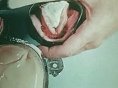 Constructing and fitting dentures, 1960s