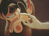 Gonorrhoea diagnostic technique, animation