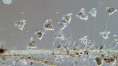 Vorticella colony on plant stalk