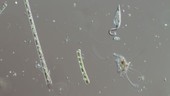 Lacrymaria sp ciliate, light microscopy
