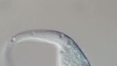 Protozoan Dileptus sp, light microscopy