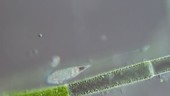 Lacrymaria sp foraging, light microscopy
