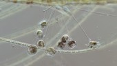 Vorticella colony on plant stalk
