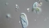 Paramecium, various species