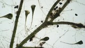 Stentor polymorphus, light microscopy
