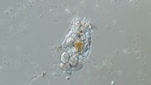 Rotifer, Brachionus sp, light microscopy