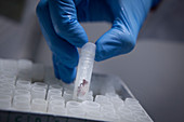 Biopsy samples at a biobank