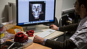 CT scan and 3D print of a human skull