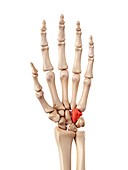 Hand bones