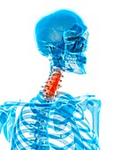 Human cervical spine pain