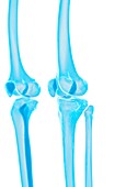Human knee bones