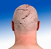 Person with cracked head,illustration