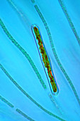 Cyanobacteria and diatom,micrograph
