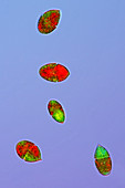 Gymnodinium dinoflagellates,micrograph