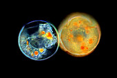 Testate amoebae,light micrograph