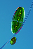 Desmid and dinoflagellate,micrograph